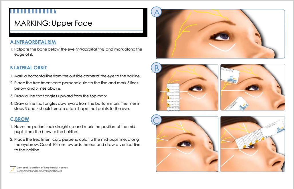 HIFU Facelifting Machine Good Effect Beauty Machine