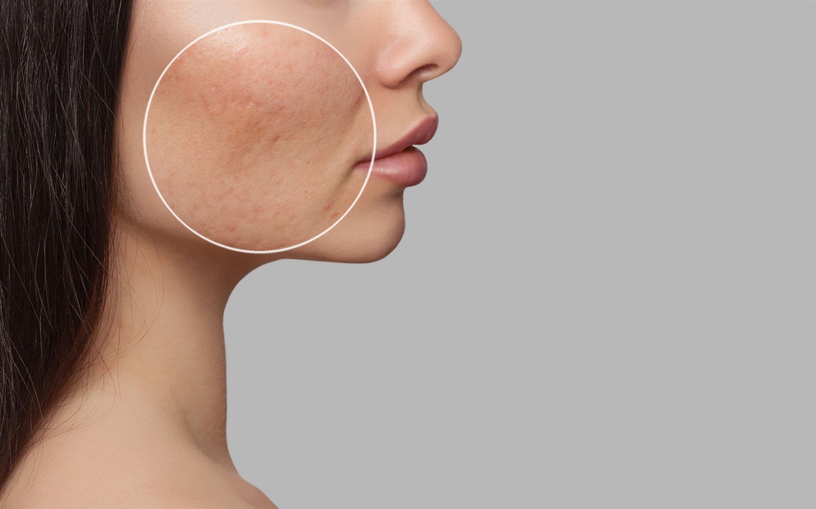 fractional co2 laser beauty machine fractional co2 laser beauty machine