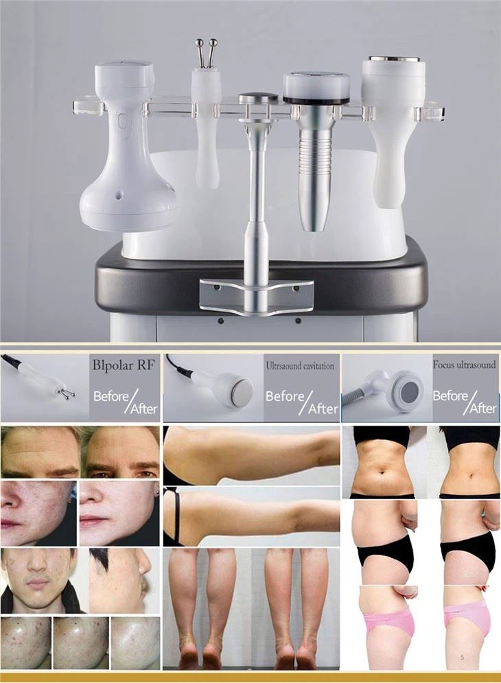 Vertical HIFU MACHINE